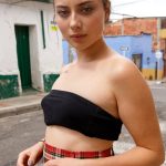 zara skolera birth marks 1 zishy 0004