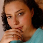 zara skolera birth marks 2 zishy 0046